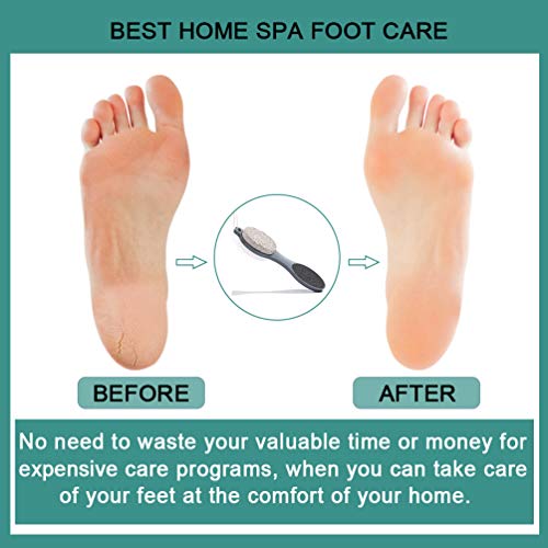 CAREHOOD 4-in-1 Foot File Callus Remover & Pedicure Scrubber Tool