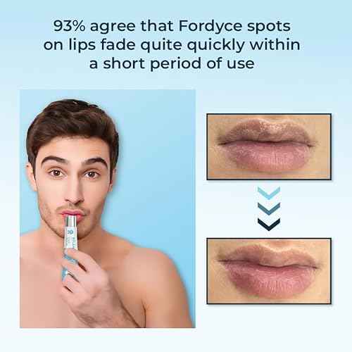 Belani Fordyce - Lip Acne Cream, Fordyce Seeds, Fordyce Cream, Moisturizes, Improves Dry, Belani Lip Mask, Chapped Lips, Reduces Dark Lips - 20ml
