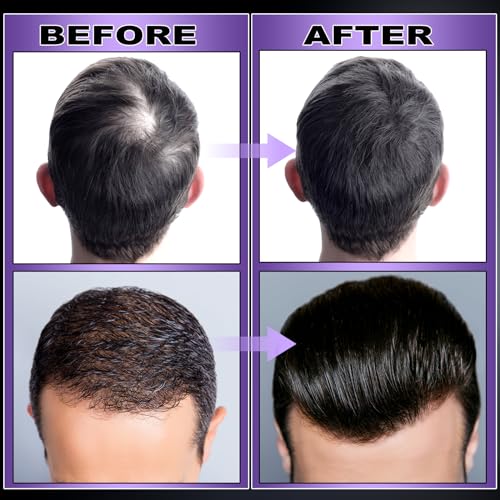 GIFBEA Organic Black Rice Water Hair Growth Serum Spray 5oz with Rosemary & Biotin