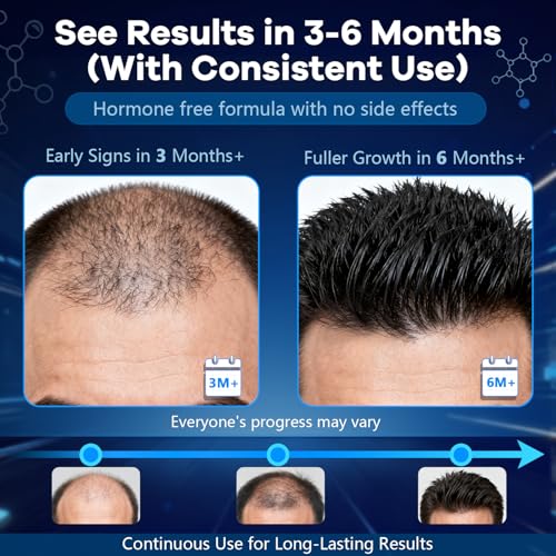 5% Minoxidil Foam for Men with Biotin - Hair Growth Treatment