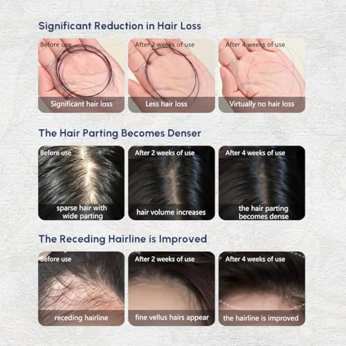 Hair Thickening Scalp Serum for Men & Women - 30ml Botanical Essence