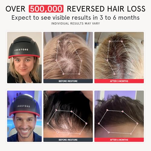 iRESTORE Elite Hair Growth System + Biotin Shampoo & Conditioner Kit