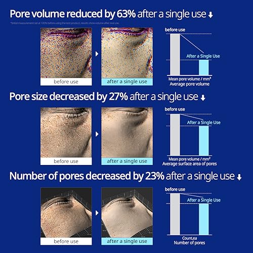 Saunan Heating Salt Mask(3.17 oz) - Top Finnish Sea Sauna Salt Mask for better skin. Healing dead skin cells and effective pore reducer. No more blackheads.