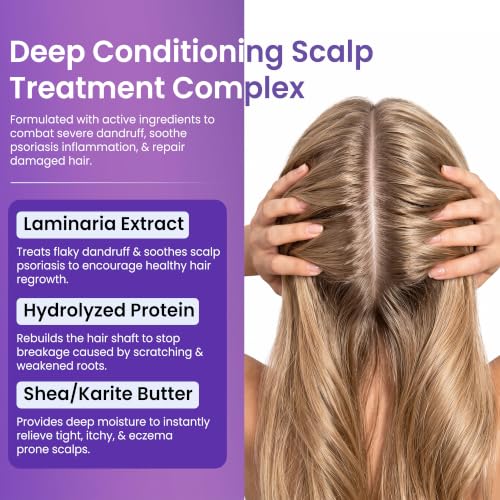 Anti Fungal Deep Conditioner for Scalp Treatment Dandruff Psoriasis Hair Care
