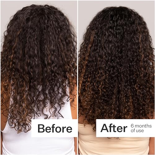 Act+ Acre Stem Cell Scalp Serum for Hair Growth – 1 fl oz