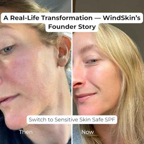 Sensitive Mineral Sunscreen Face SPF30 moisturizer, No white cast I Anti Aging I Non Toxic I Eco Friendly I made with zinc oxide for sensitive skin and acne prone skin, dermatologist recommended