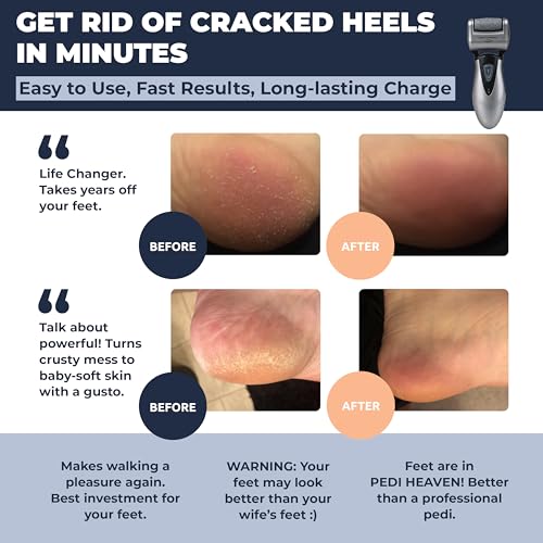 Own Harmony Electric Callus Remover - Rechargeable Foot File with 3 Rollers