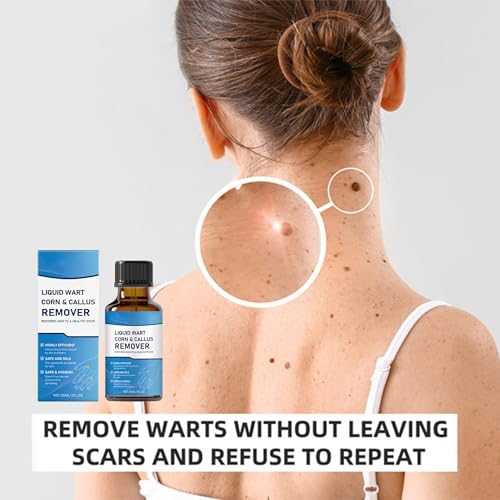 GIGAHEAL Wart & Mole Remover Serum for Face & Body - Fast Acting