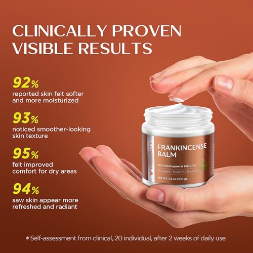 Vigority Frankincense Balm: Whipped Revitalizes & Smooths Cream for Dry, Mature & Aging Skin with Helichrysum & Bakuchiol? Moisturizer & Nourishes for Face & Body - Lightweight & Non-greasy ? 3.4 oz