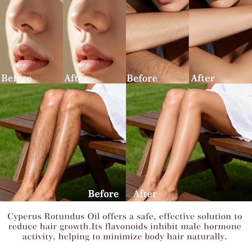 Cyperus Rotundus Oil Hair Removal, 60ml Natural Inhibitor