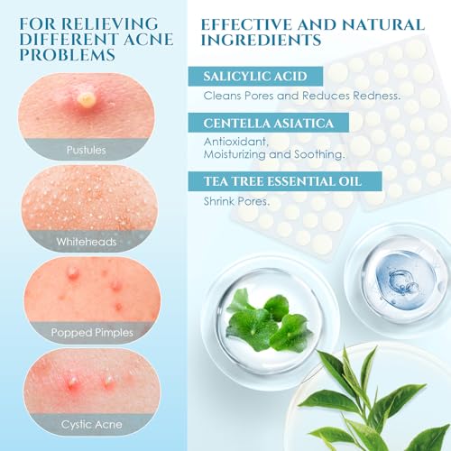 Pimple Patches Acne Patches, PITHER Day and Night Hydrocolloid Patch for Covering Zits and Blemishes Invisible Zit Patches with Tea Tree Oil, Salicylic Acid, Centella Asiatica (288 Count, 2 Size)