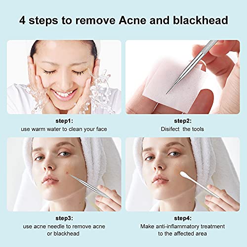 Blackhead Remover Tool 2-in-1 Pimple Extractor - Stainless Steel