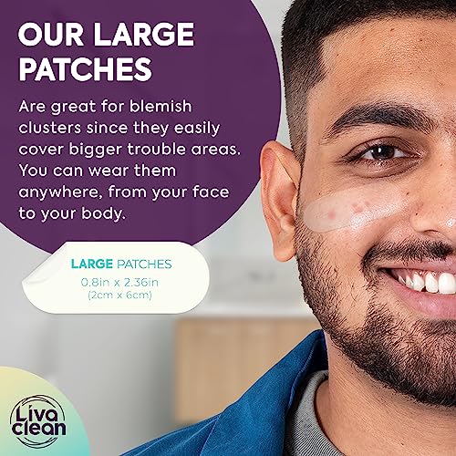 LivaClean 50CT Large Hydrocolloid Acne Patches - for Pore Spots Nose Face Cystic Pimple Zit Patch - Big Pimple Patches Hydrocolloid Bandages Strips Stickers Pimple Patch XL Large Acne Patch Large