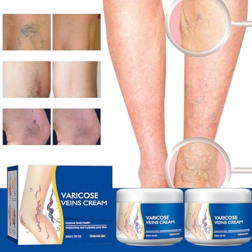Varicose Veins Cream for Legs, Gentle Soothing Skin Cream for Legs, Moisturizing Skin Care, 1.76 Oz (2PCS)