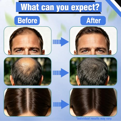 GHK-Cu Copper Peptide Hair Growth Serum with Biotin