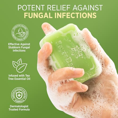 Roycederm Antifungal Bar Soap - Tea tree Oil Soap - Athlete¡¯s Foot Treatment for Jock Itch & Ringworm - Medicated Antifungal Soap with Clotrimazole 1% - Tea Tree Oil Scent, 2 Pack