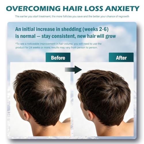 KOGEEYY 2.11oz Minoxidil Foam for Men - Hair & Beard Growth, Extra Strength, Unscented, 1 Pack