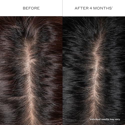 Zenagen Densifying Hair Serum 3.4 Fl Oz | Boosts Hair Density & Thinning