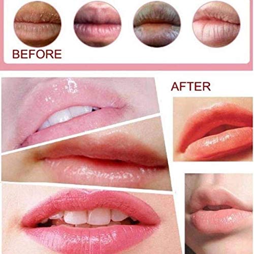 Jakuva 29PCS Collagen Lip Mask,Gel Moisturizing Lip Plumper Lip Patches For Anti Wrinkle,Anti Chapped and Moisturizing,Lip Sleeping Mask, Gold