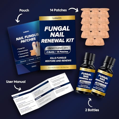Toenail Fungus Treatment 25% Undecylenic Acid & Tea Tree Oil