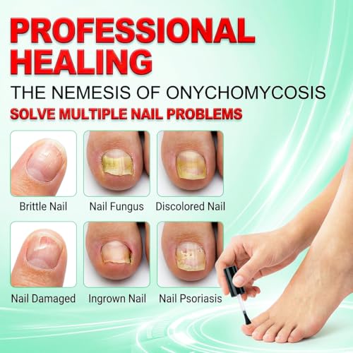 Chamex Extra Strength Toenail Fungus Treatment with Natural Extracts