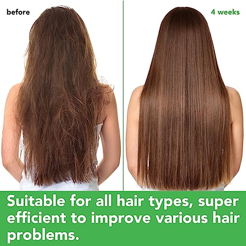 FSLHCY Rosemary Mint Shampoo & Conditioner Set with Biotin