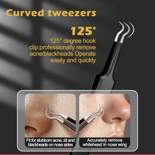 4-in-1 Blackhead Remover Tweezers Set - Stainless Steel