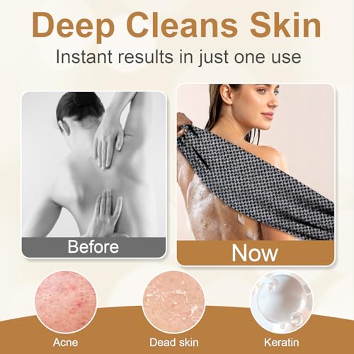 Blissal Exfoliating Shower Towel,Advanced Exfoliating Microfiber Towel,Premium Scrub Bathroom Towel Set,2-in-1 Exfoliatings Towels-Body Scrubber with 2 Sides for All Skin Types
