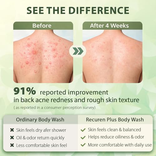 Recuren Plus Antifungal Body Wash - Back Acne & Jock Itch Relief