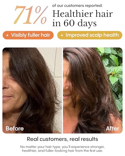 Frøya Organics Mature Hair & Scalp Care Set - 3pc Kit
