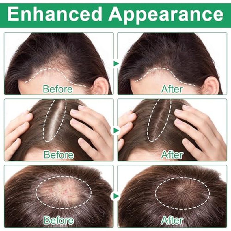 Rosemary Hair Growth Serum Roll-On for Thinning Hair, 2-Pack