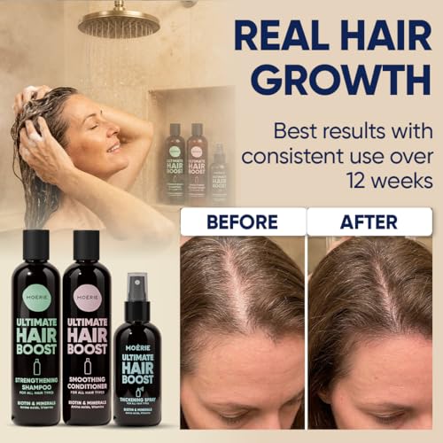 Moerie Hair Growth Shampoo, Conditioner & Spray Set