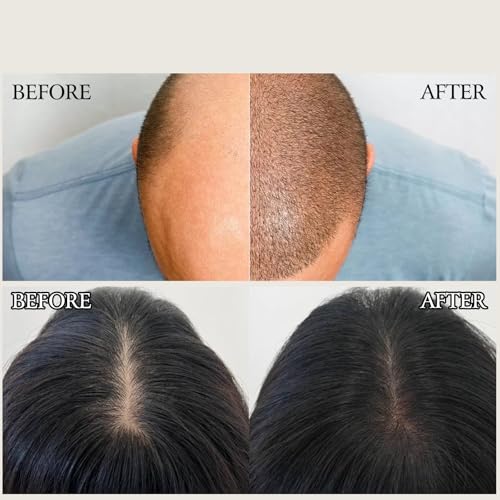 YIVANNUO 2PCS Deoxyribose Sugar Hair Growth Gel Serum 60ml