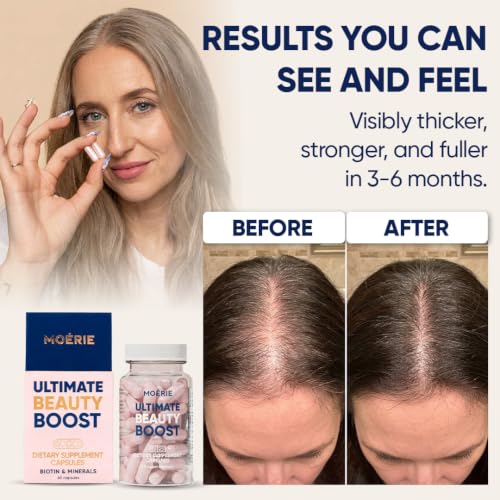 Moerie Hair Boost Supplements with Biotin & Minerals - 180 Capsules