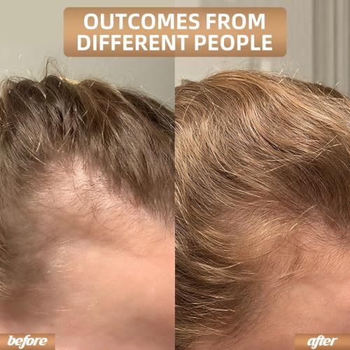 Red Light Therapy Hair Growth Cap | Cordless LED Hat
