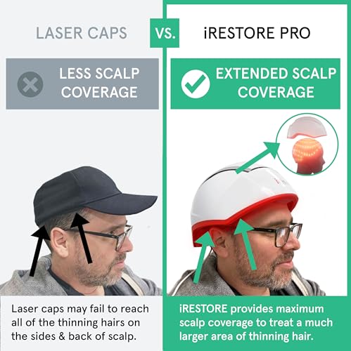 iRestore Professional 282 | FDA Cleared Laser Hair Growth Device | Red Light Therapy for Hair Growth | Laser Cap for Hair Regrowth, Restore Laser Helmet, Hair Loss Treatments for Men & Women Alopecia