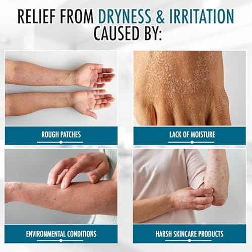GLY MIRACLE Moisturizing Body Cream Lotion, 16 ounce - Non-Greasy Skin Humectant for Extremely Dry Skin, Hands, Body, and Feet, Light Fresh Scent with Pure Glycerin for Nourishing Hydration.