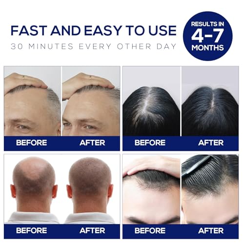 Laser Hair Growth Cap - LLLT Device for Men & Women