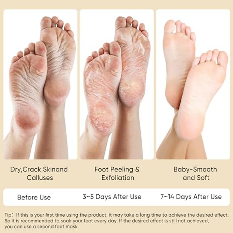 Coconut Foot Peeling Mask - 3 Pairs Exfoliating Foot Masks for Smooth Feet