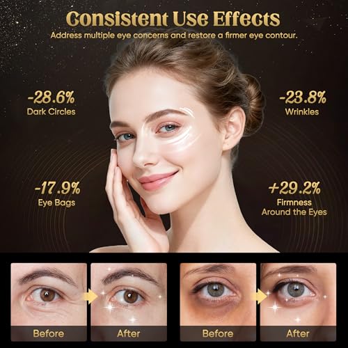 Red Light Therapy for Eyes, Red Light Eye Therapy with NIR, 3 Modes with Timing Function, Red Light Eye Mask for Reducing Dark Circles and Puffiness, Smoothing Fine Lines(Black & 3 modes)