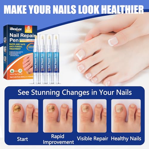 Toenail Fungus Treatment Pen - 25% Undecylenic Acid