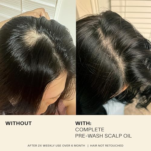 JVN Complete Pre-Wash Scalp Oil 1.7 Fl Oz - Pack of 1