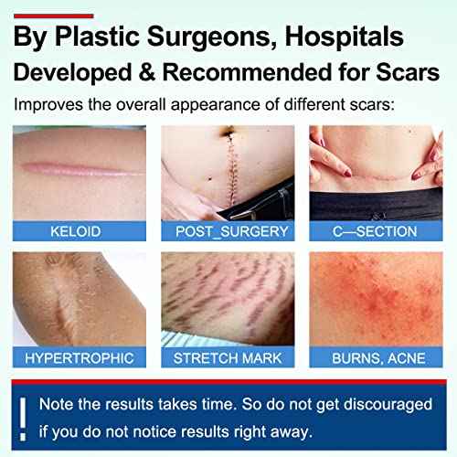 Silicone Scar Sheets Tape for Surgical Scars, C Section Scar Silicone Strips, Medical Grade, Reusable, Soften and Flattens Scars, Breast, Keloid, Professional Scar Patches. (1.8x157 Inch)