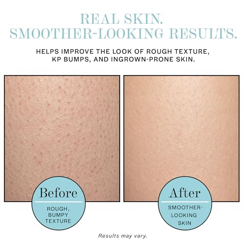 Exfoliating Body Scrub for Ingrown Hairs & KP Bumps - AHA+BHA