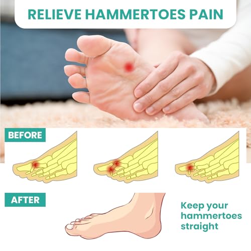 Welnove Hammer Toe Straightener Cushions - 8 Pcs Silicone Pads