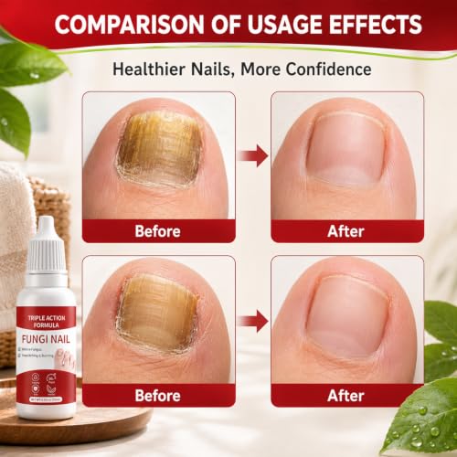 2-Pack Gentle Plant-Based Toenail Care Essence for Healthy Nails