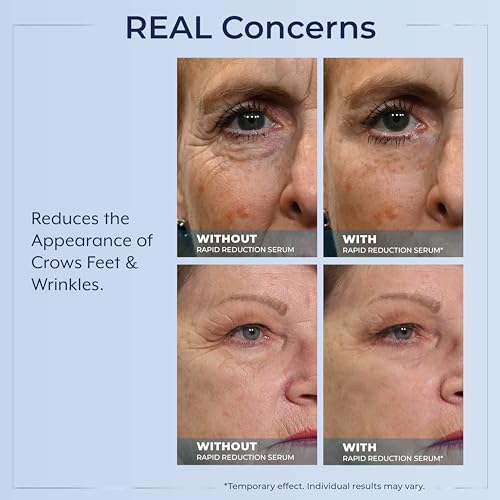 Plexaderm Rapid Reduction Eye Serum - 30 Single-Use Pods for Under-Eye Bags