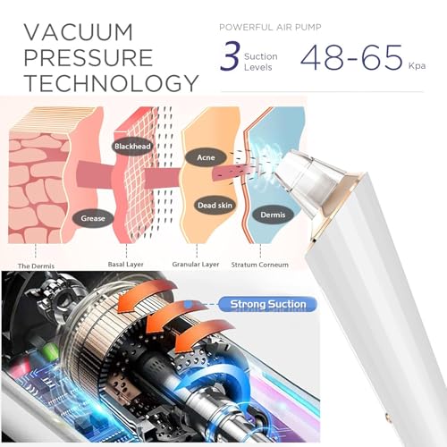 Upgraded Blackhead Remover Pore Vacuum with 3 Probes & 3 Suction Levels