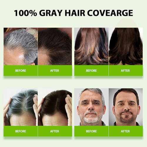 RKQNIER Dark Brown Hair Dye Shampoo for Gray Coverage - 15 Min