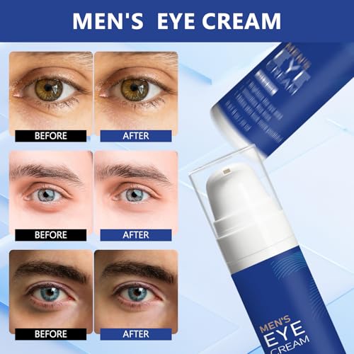 Mens Eye Bags Treatment Cream, Instant Eye Serum for Dark Circles, Wrinkle Smoothing Serum with Peptide & Collagen, Lightweight Moisturizer - 20ml